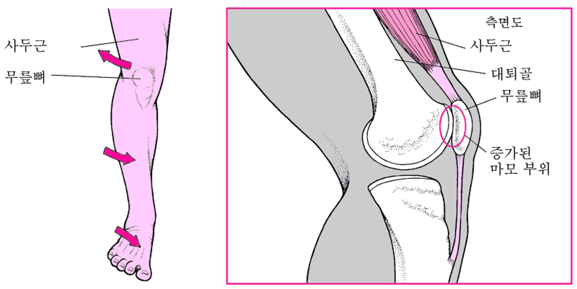 무릎 앞부분이 아플 때
