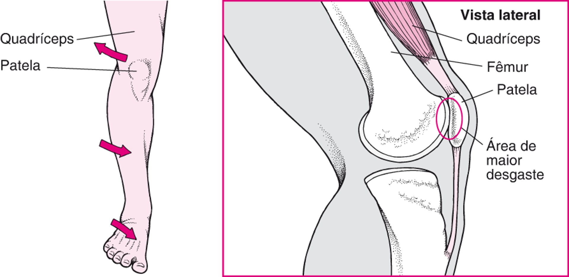 Quando surgem dores na parte frontal do joelho