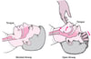 Opening an Airway in an Adult or Child