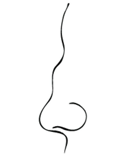Sattelnase (Deformität der Nase)