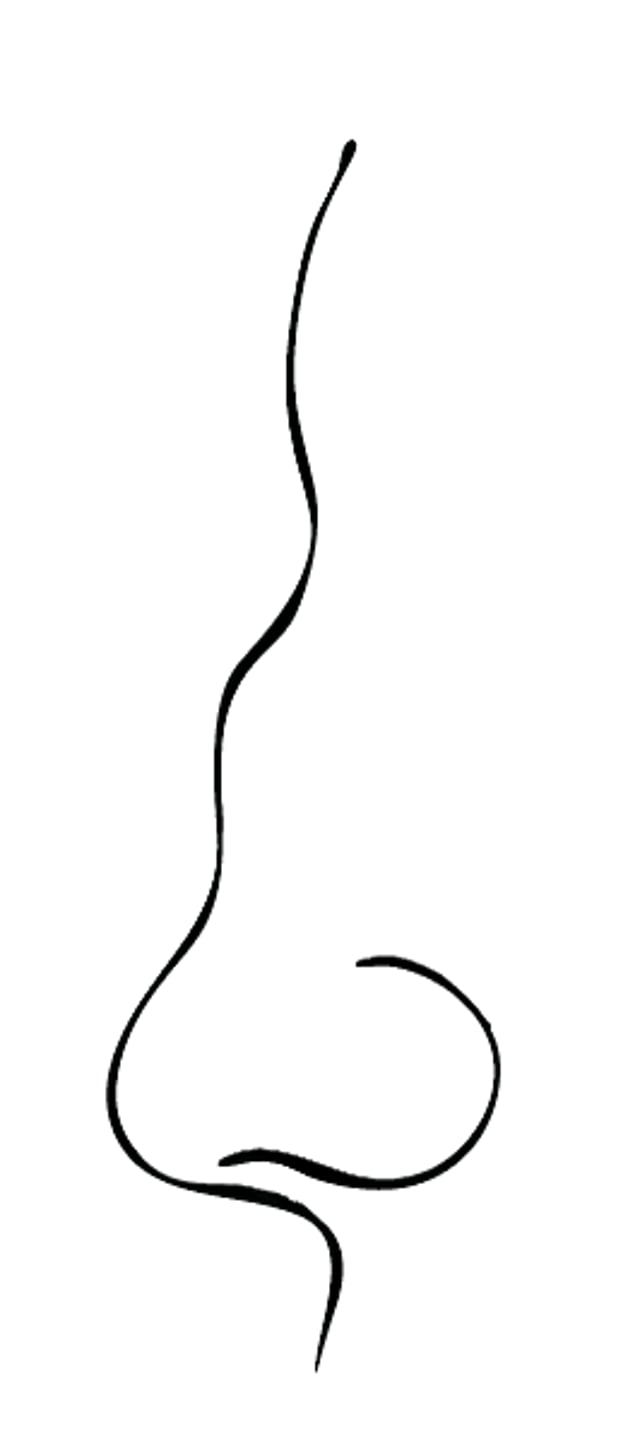 Déformation de la selle turcique