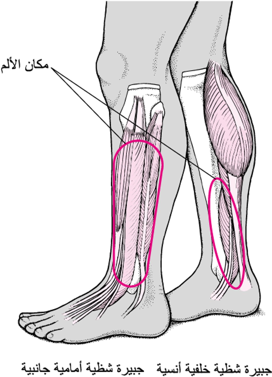 جَبائِرُ حَرفِ الظُّنبوب
