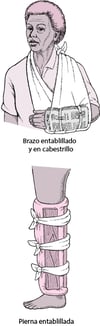 Férulas más usadas