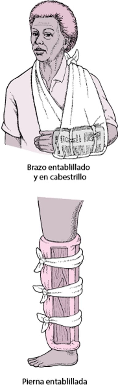 Férulas más usadas