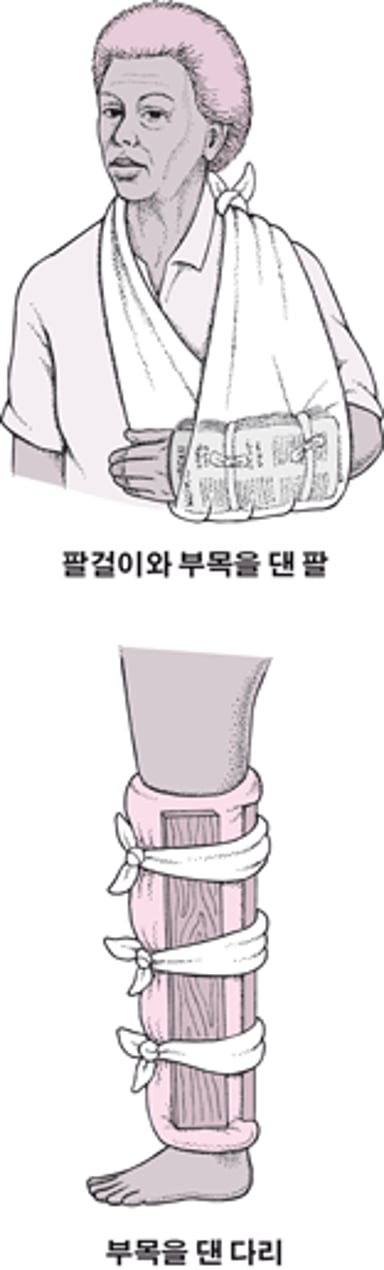 흔히 사용하는 부목