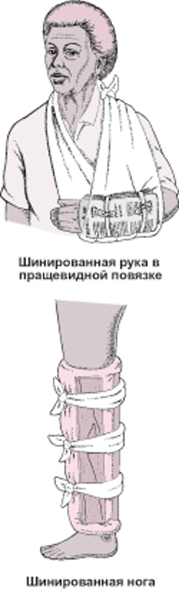 Импровизированные шины