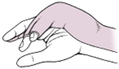 Локтевая желобоватая шина