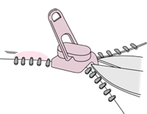 إزالة السحّاب من جلد القضيب