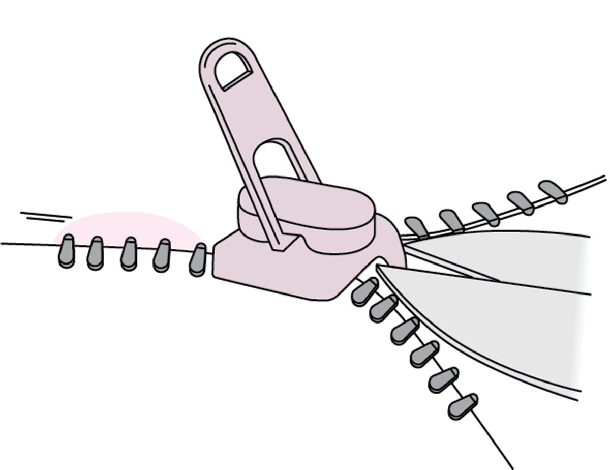 Retirar una cremallera de la piel del pene