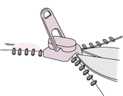 陰茎皮膚からのファスナーの除去