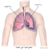 الاسترواحُ الصَّدري Pneumothorax