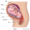 임신