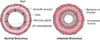 Bronchoscopy