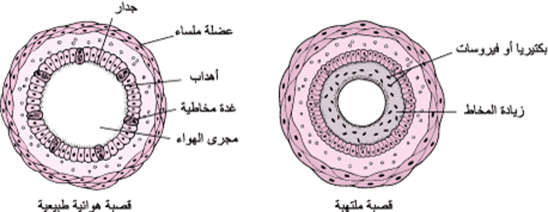 تَنظير القصبات