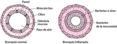 Broncoscopia