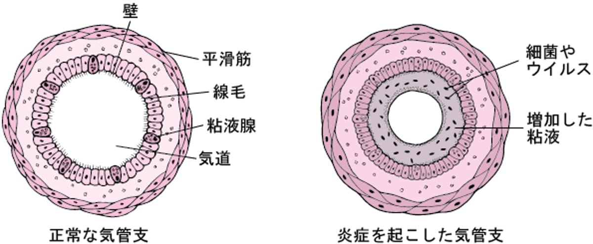 気管支鏡検査きかんしきょうけんさ