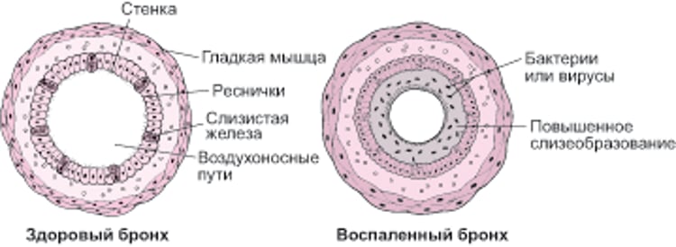 бронхоскопия;