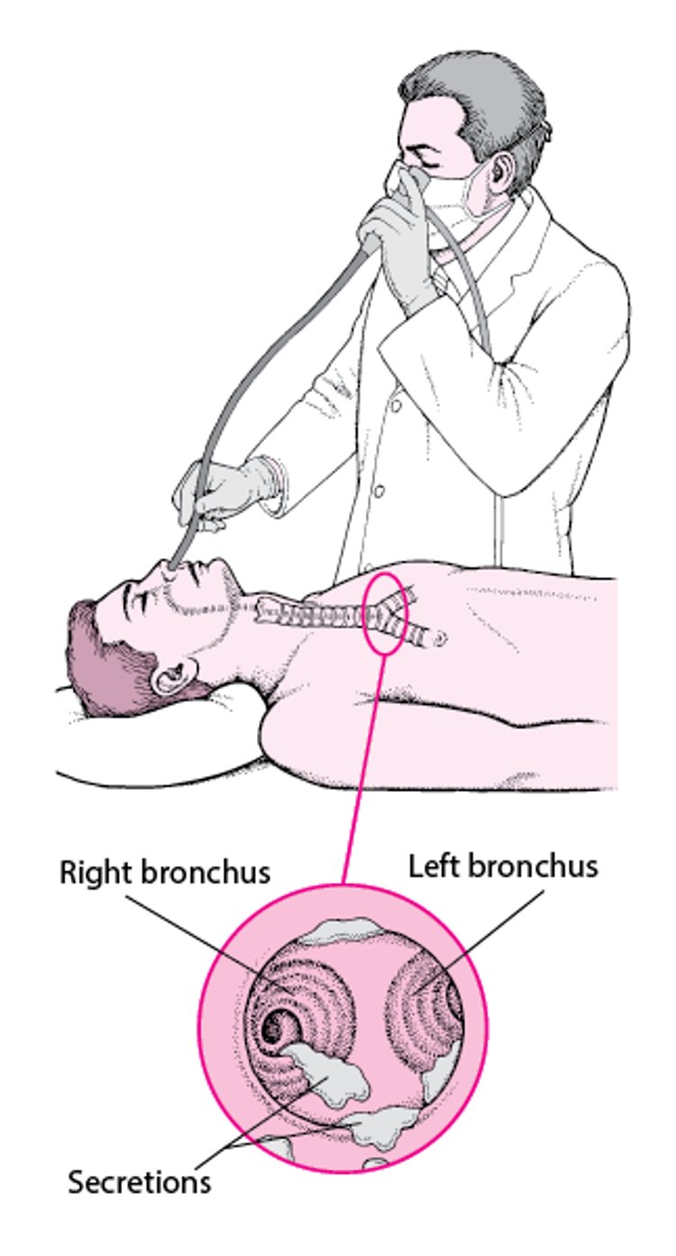 Understanding Flexible Bronchoscopy
