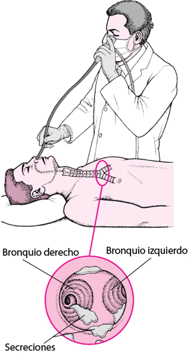 Qué es la broncoscopia flexible