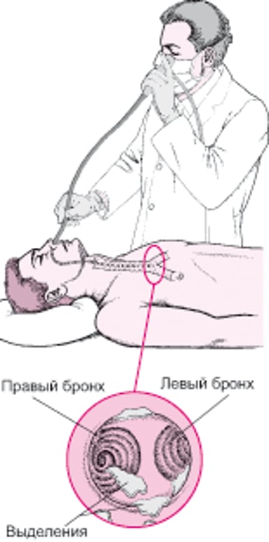 Представление о гибкой бронхоскопии