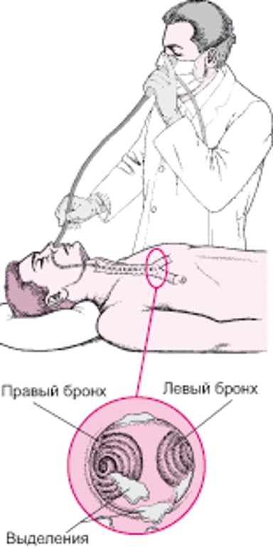 Представление о гибкой бронхоскопии