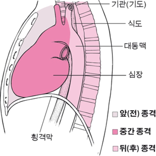 종격 찾기