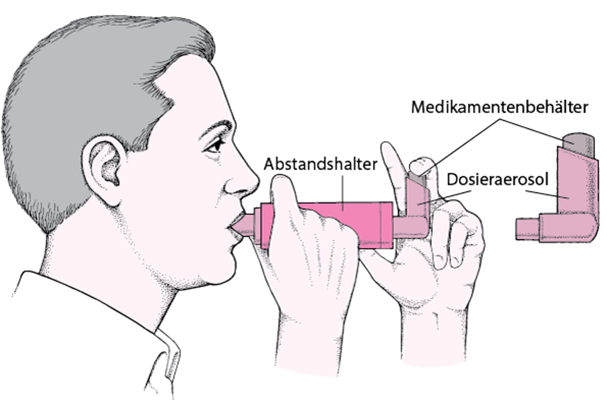 So wird ein Dosieraerosol mit einem Spacer benutzt: