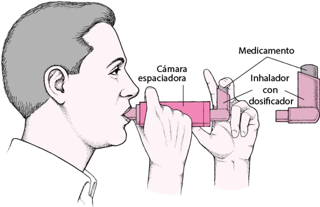 Image:Cómo usar un inhalador con dosificador con una cámara espaciadora ...