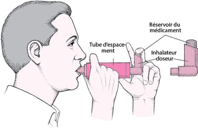 Utilisation d’un aérosol-doseur avec un tube d’espacement