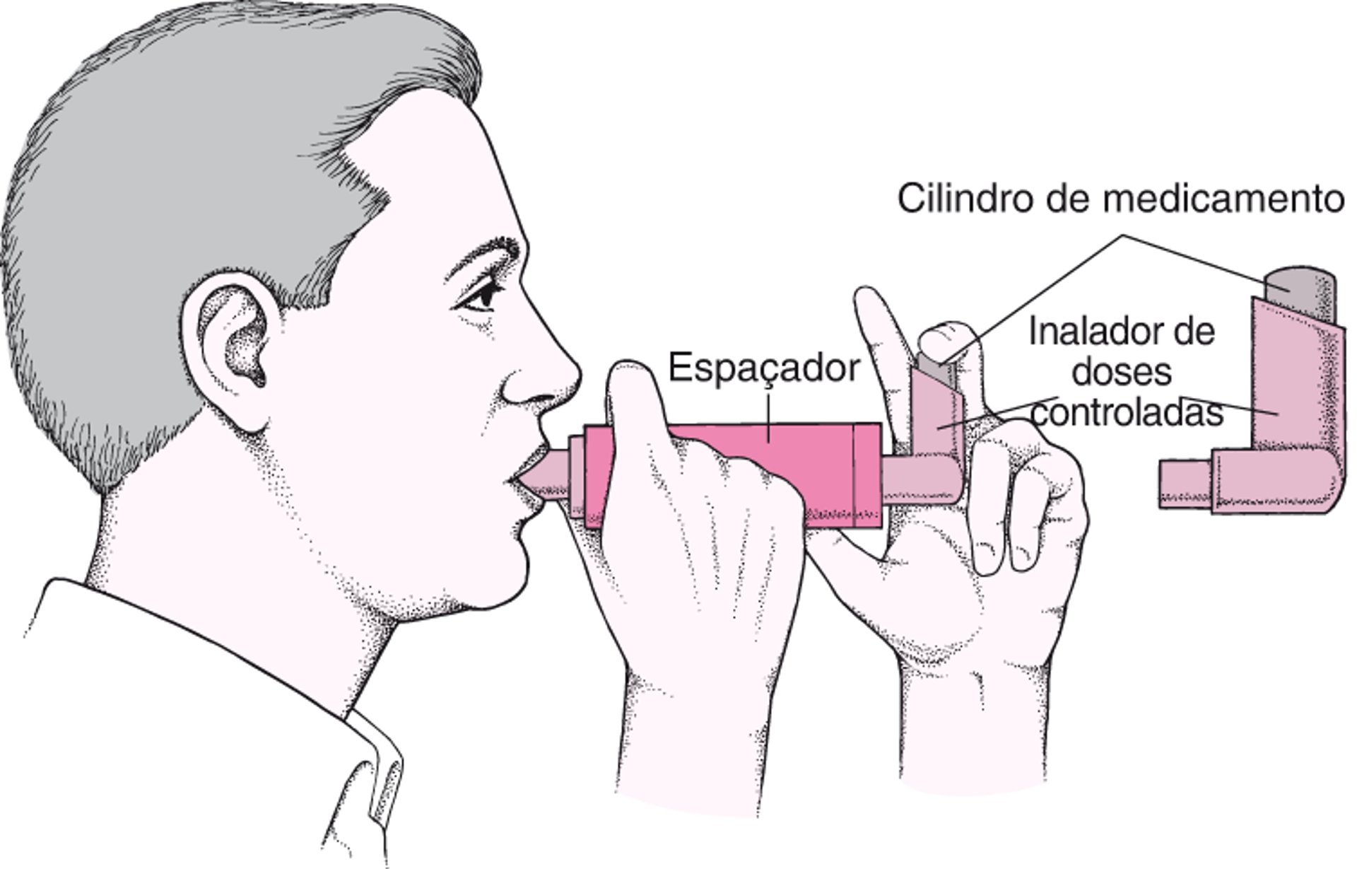 Como utilizar um inalador de dose controlada com um espaçador