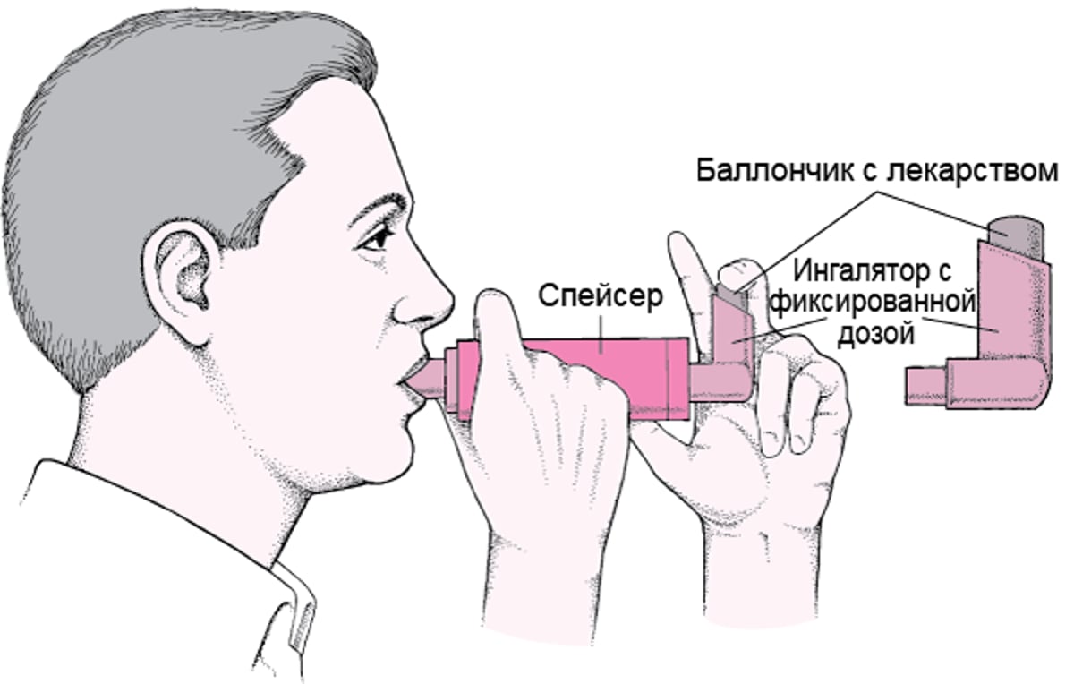Как пользоваться дозирующим ингалятором со спейсером
