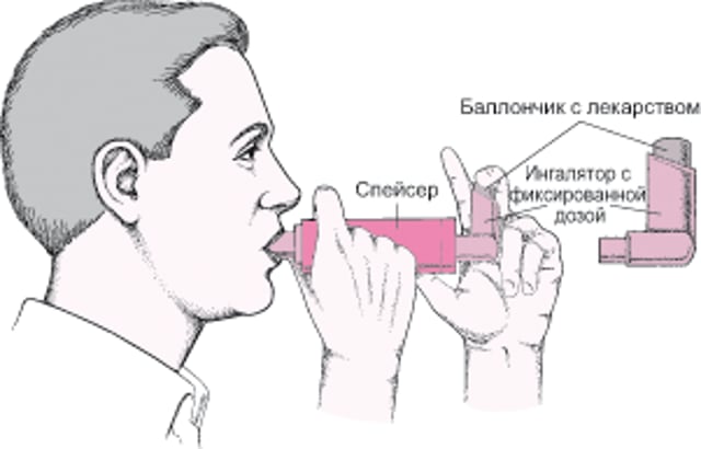 Как пользоваться дозирующим ингалятором со спейсером