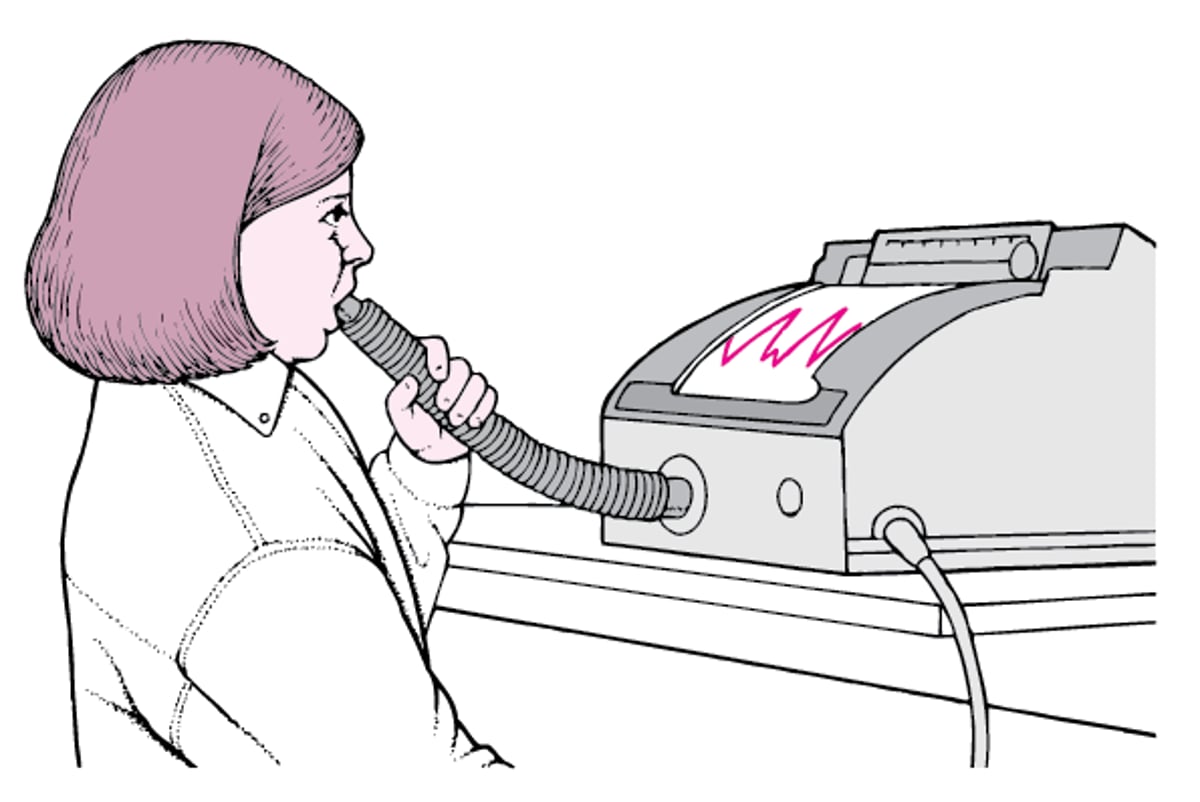 Spirometer