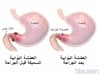 تضيّق البواب