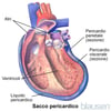 Sacco pericardico