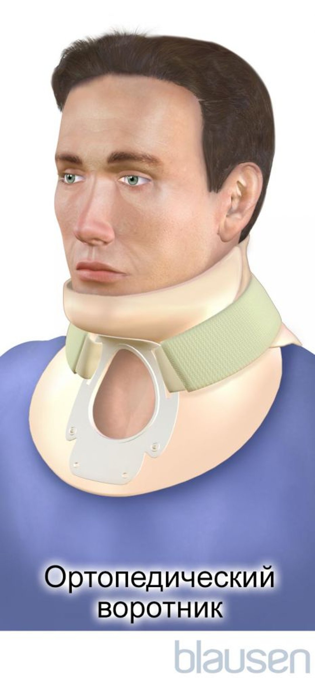 Ортопедический воротник «Филадельфия»