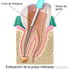 Conducto radicular
