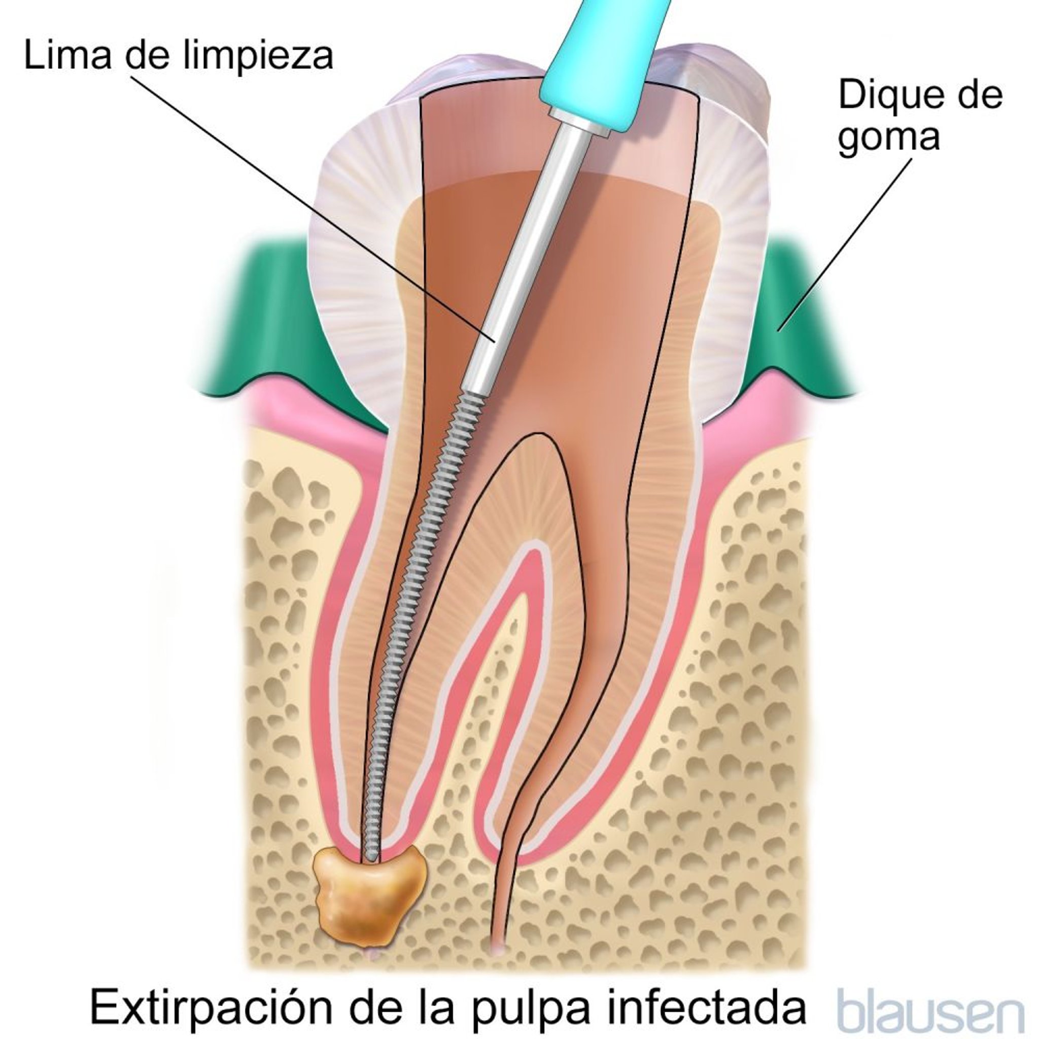Conducto radicular
