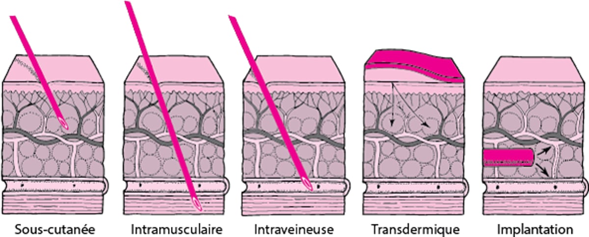 Administration transcutanée