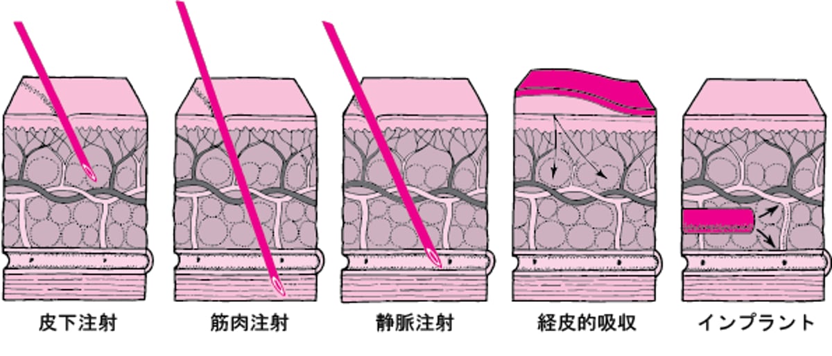 皮膚を介した投与