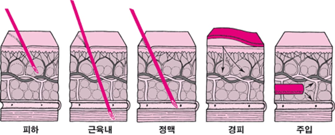 피부를 통해