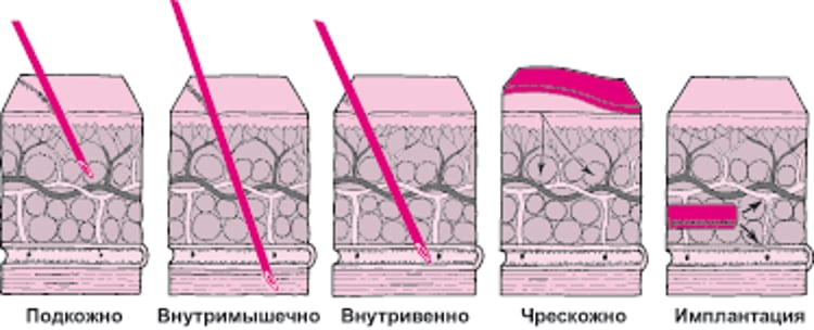 Чрескожное введение