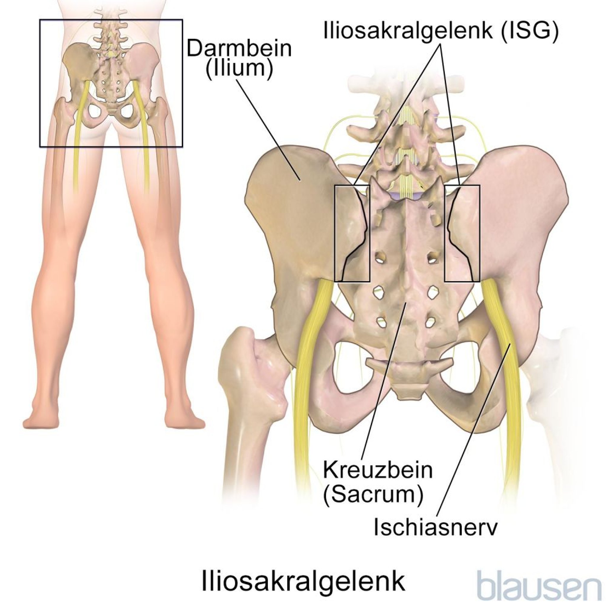 Iliosakralgelenk