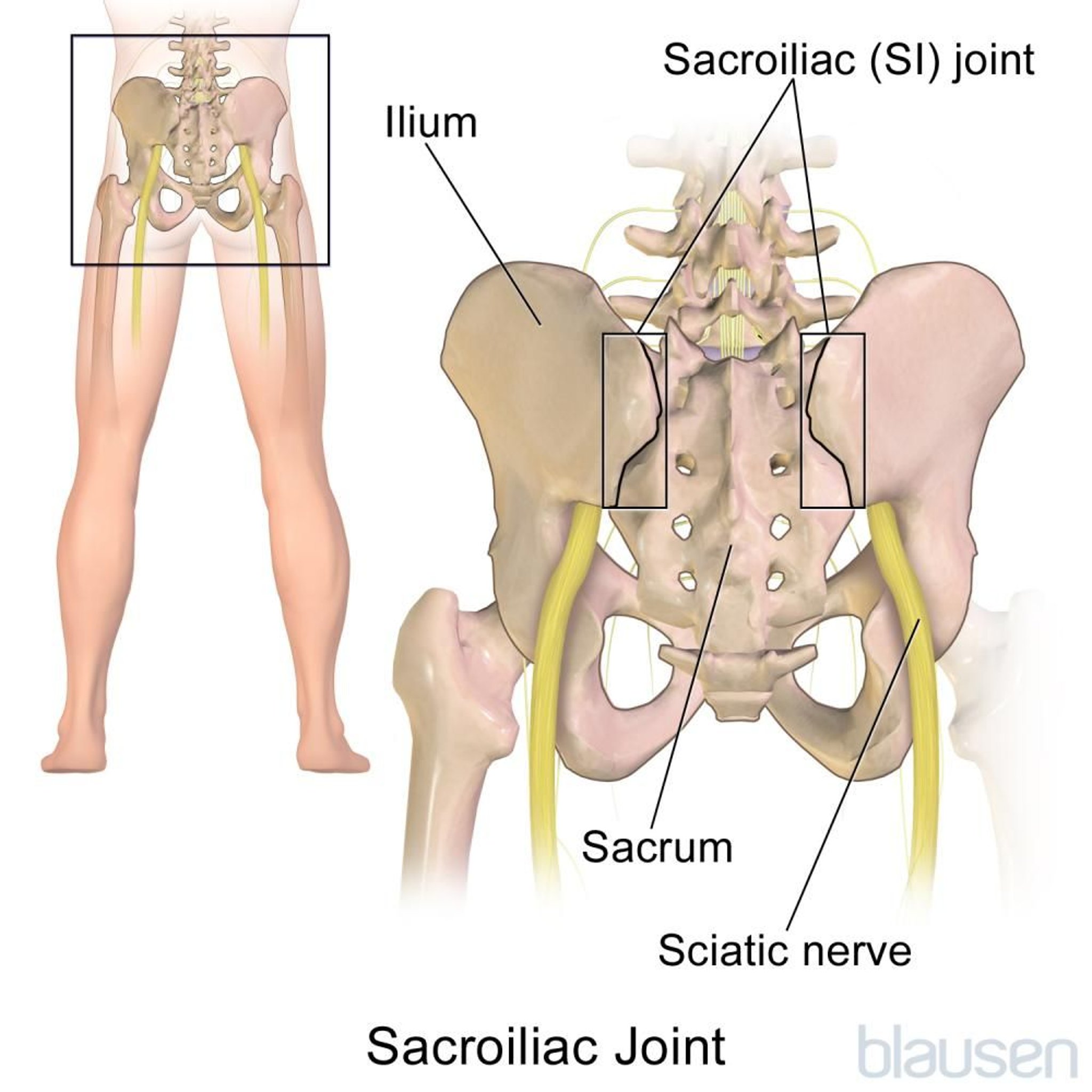 Articulación sacroilíaca