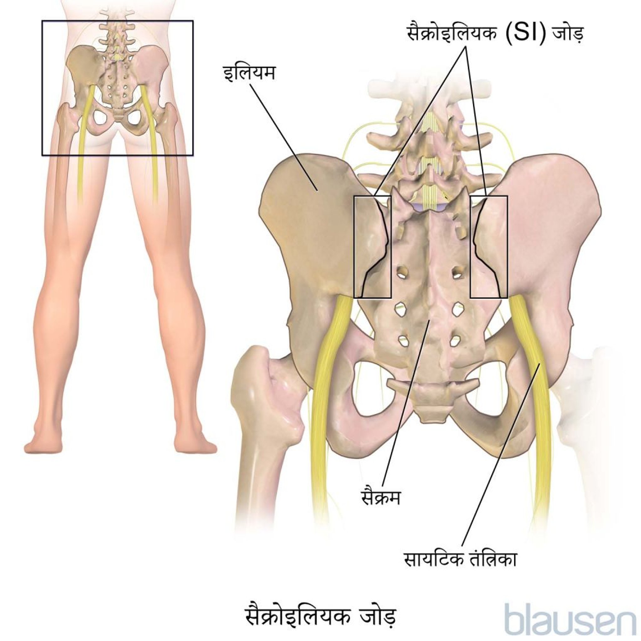 सैक्रोइलियक जोड़