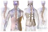 Corsets dans le traitement de la scoliose