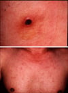 Rickettsiosis fluvial japonesa
