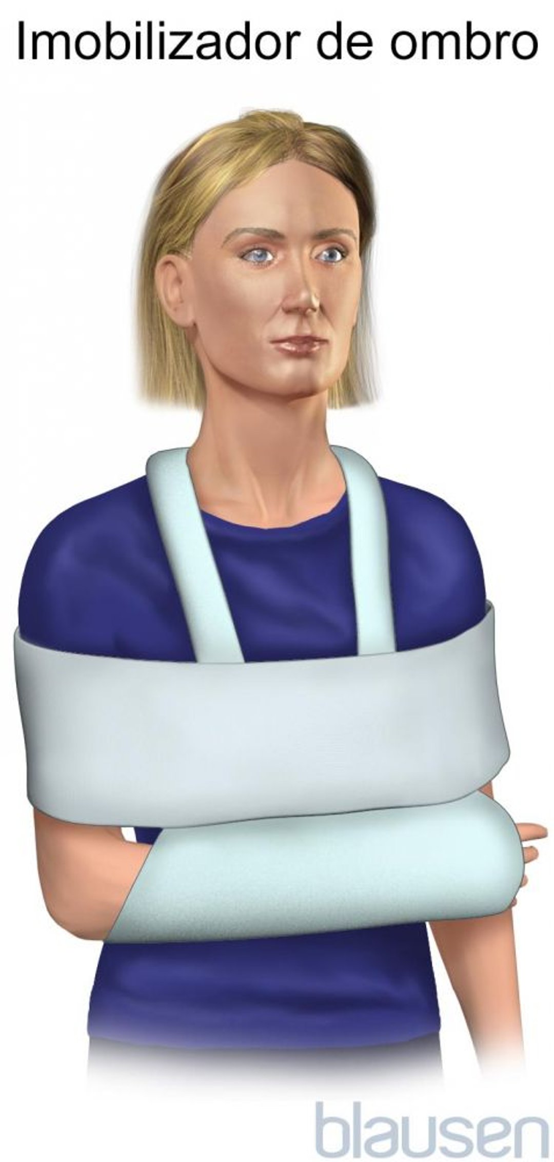 Imobilizador de ombro