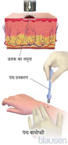 पंच बायोप्सी