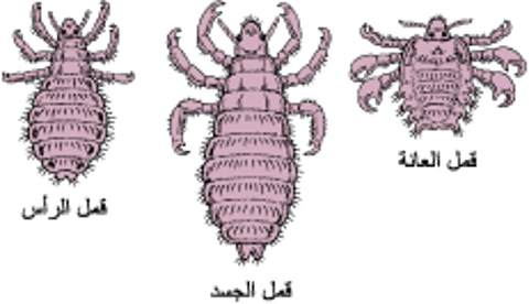 نظرةٌ فاحِصة حول القمل